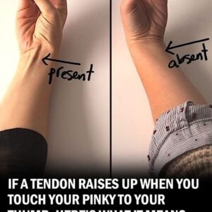 If a Tendon Raises Up When You Touch Your Pinky to Your Thumb, Here’s What It Could Mean